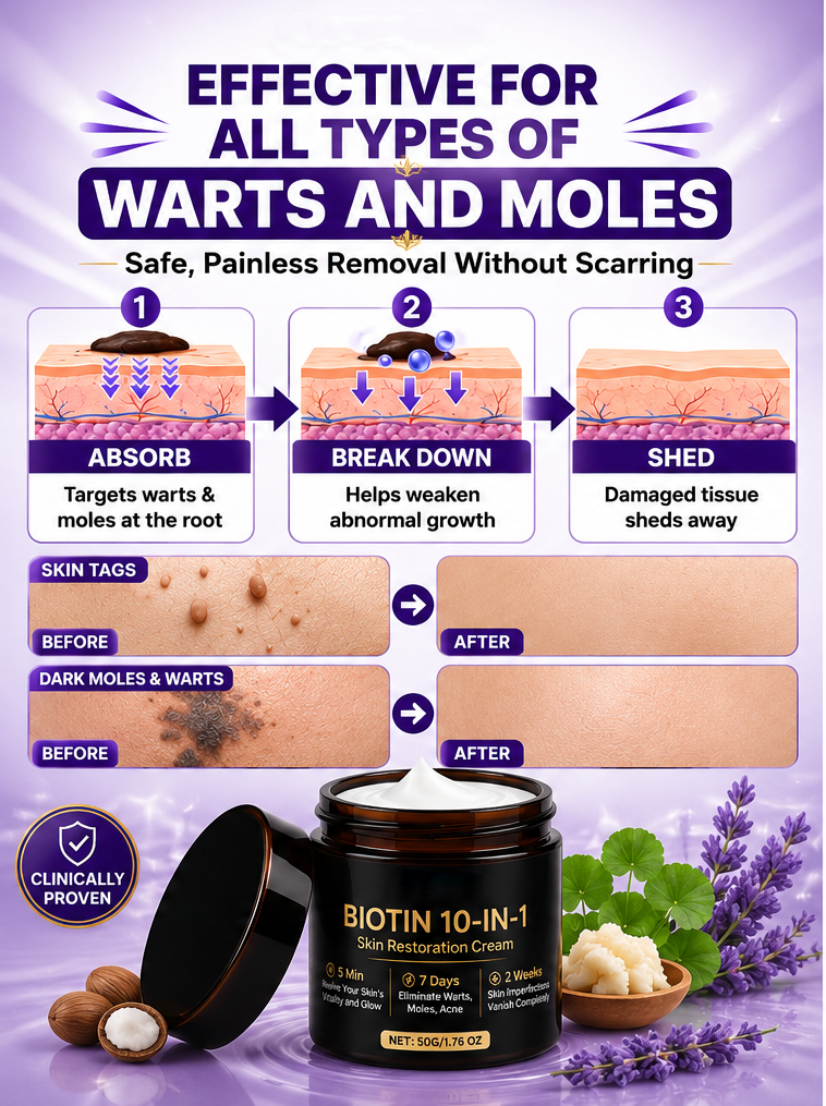 Warts