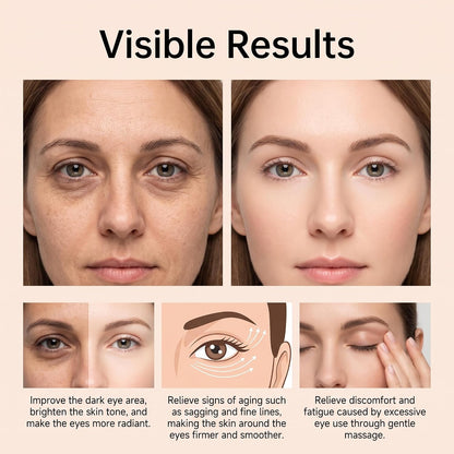 ⏳ LAST 30 MINUTES! 🔥 Get 50% OFF  Eye Cream Before This Deal Ends! ✨
