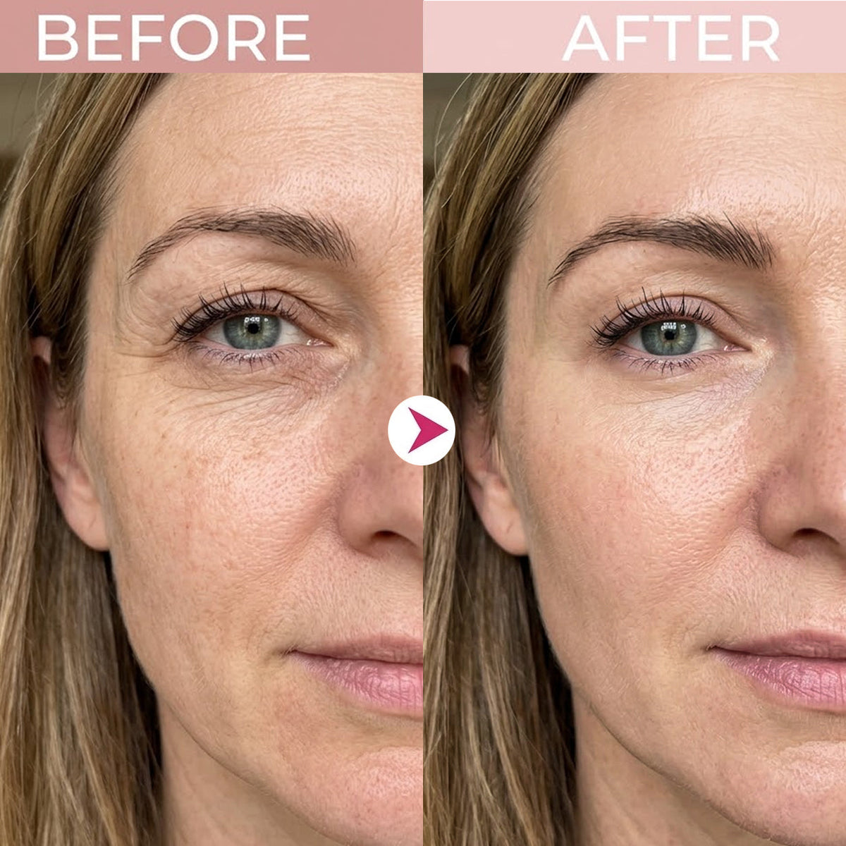 ⏳ LAST 30 MINUTES! 🔥 Get 50% OFF  Eye Cream Before This Deal Ends! ✨