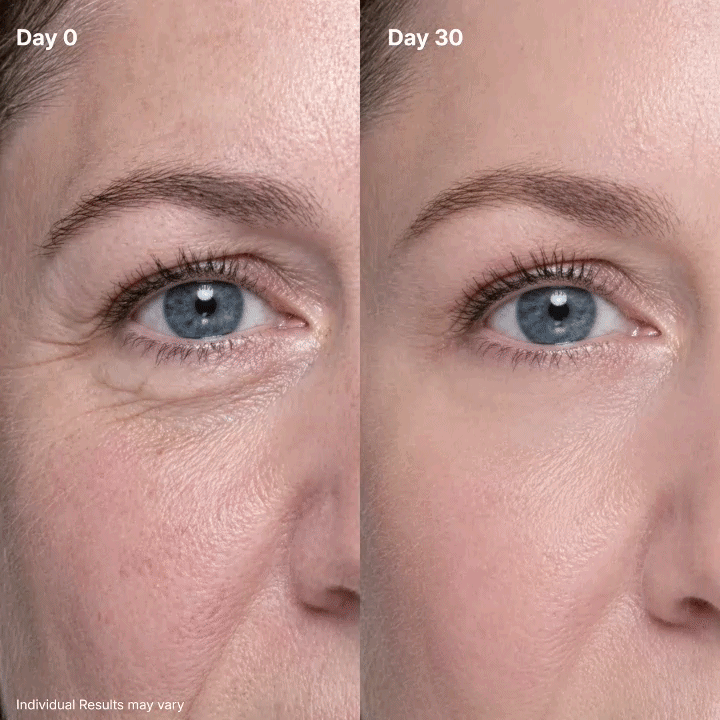 ⏳ LAST 30 MINUTES! 🔥 Get 50% OFF  Eye Cream Before This Deal Ends! ✨